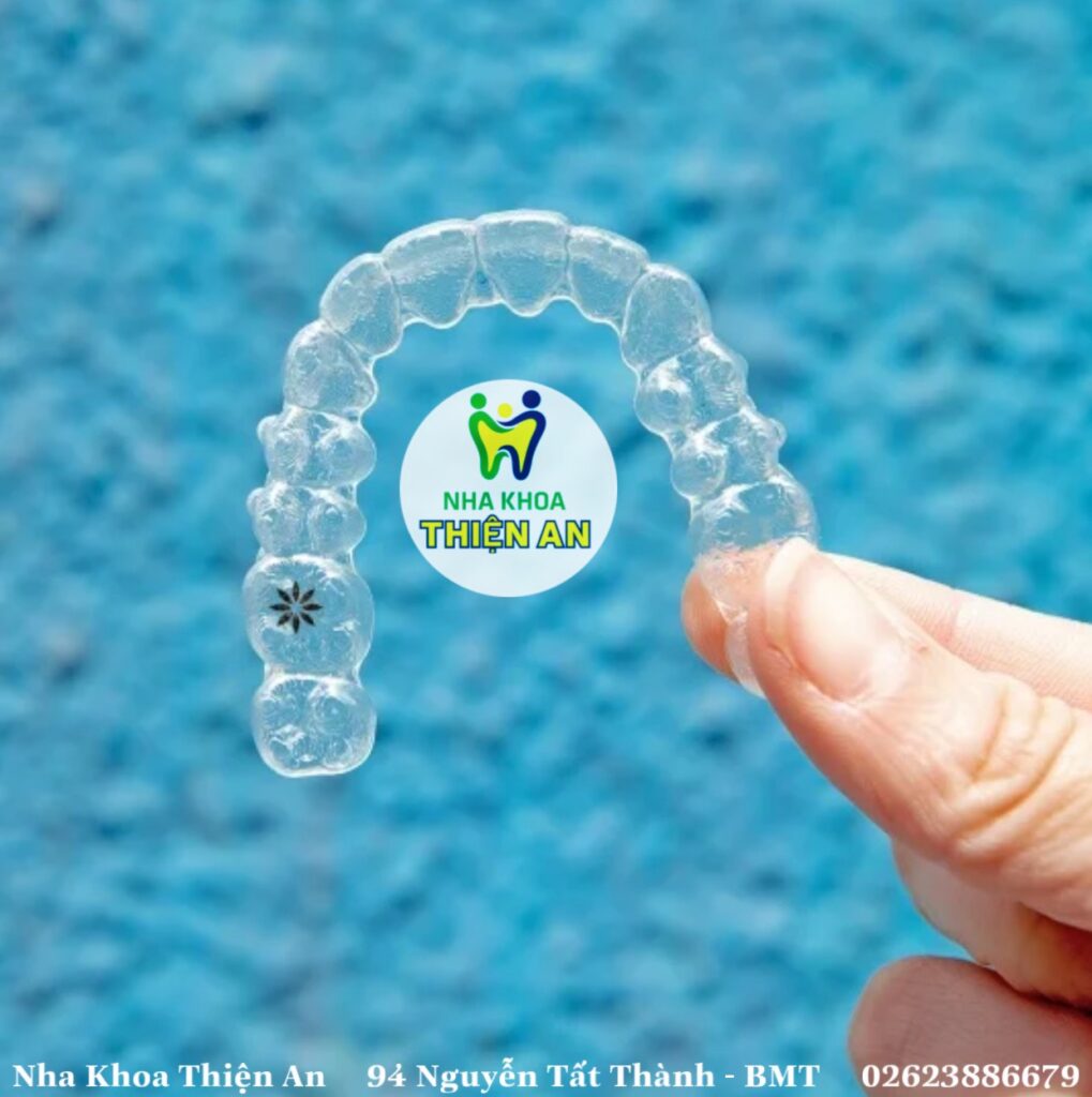 niềng răng trong suốt