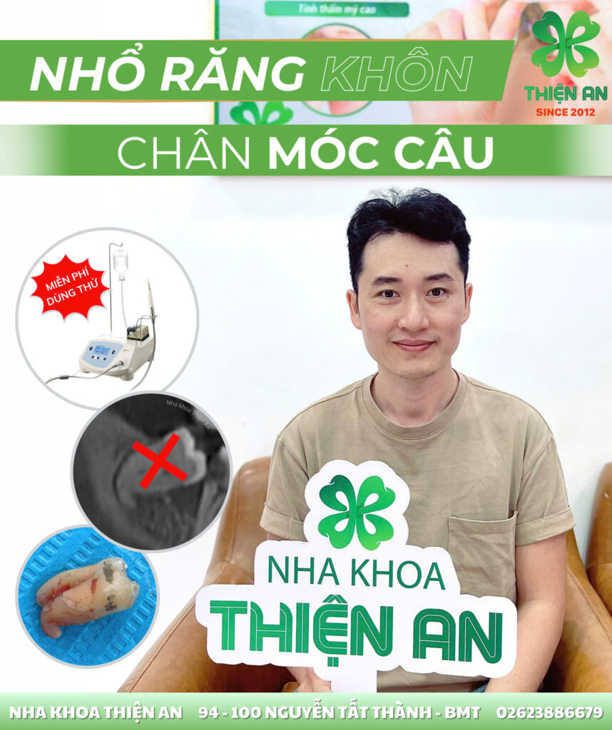 nhổ răng khôn