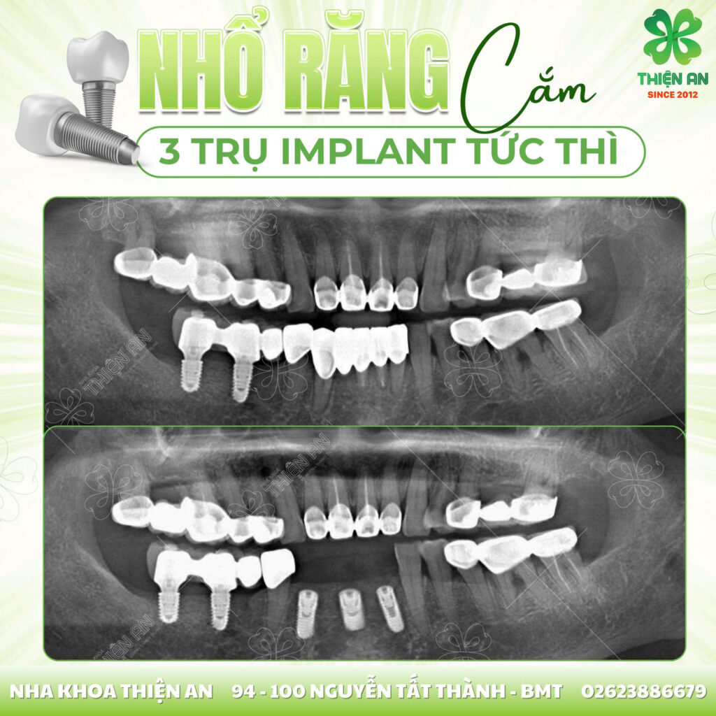 nên chọn nha khoa nào tại buôn ma thuột