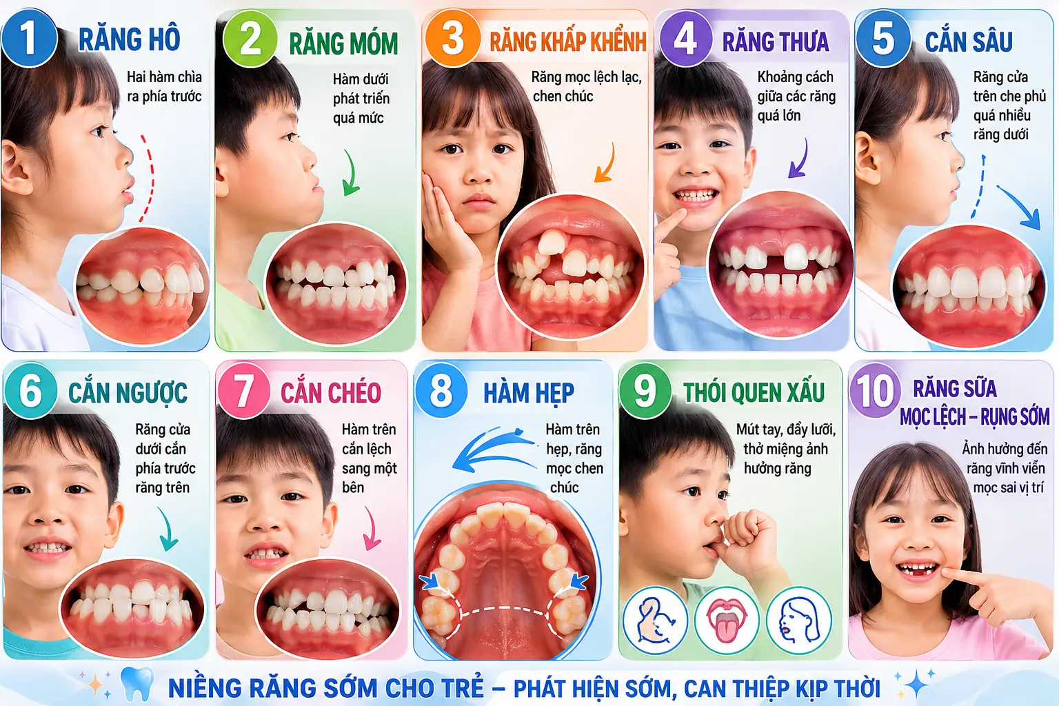 Niềng răng trẻ em