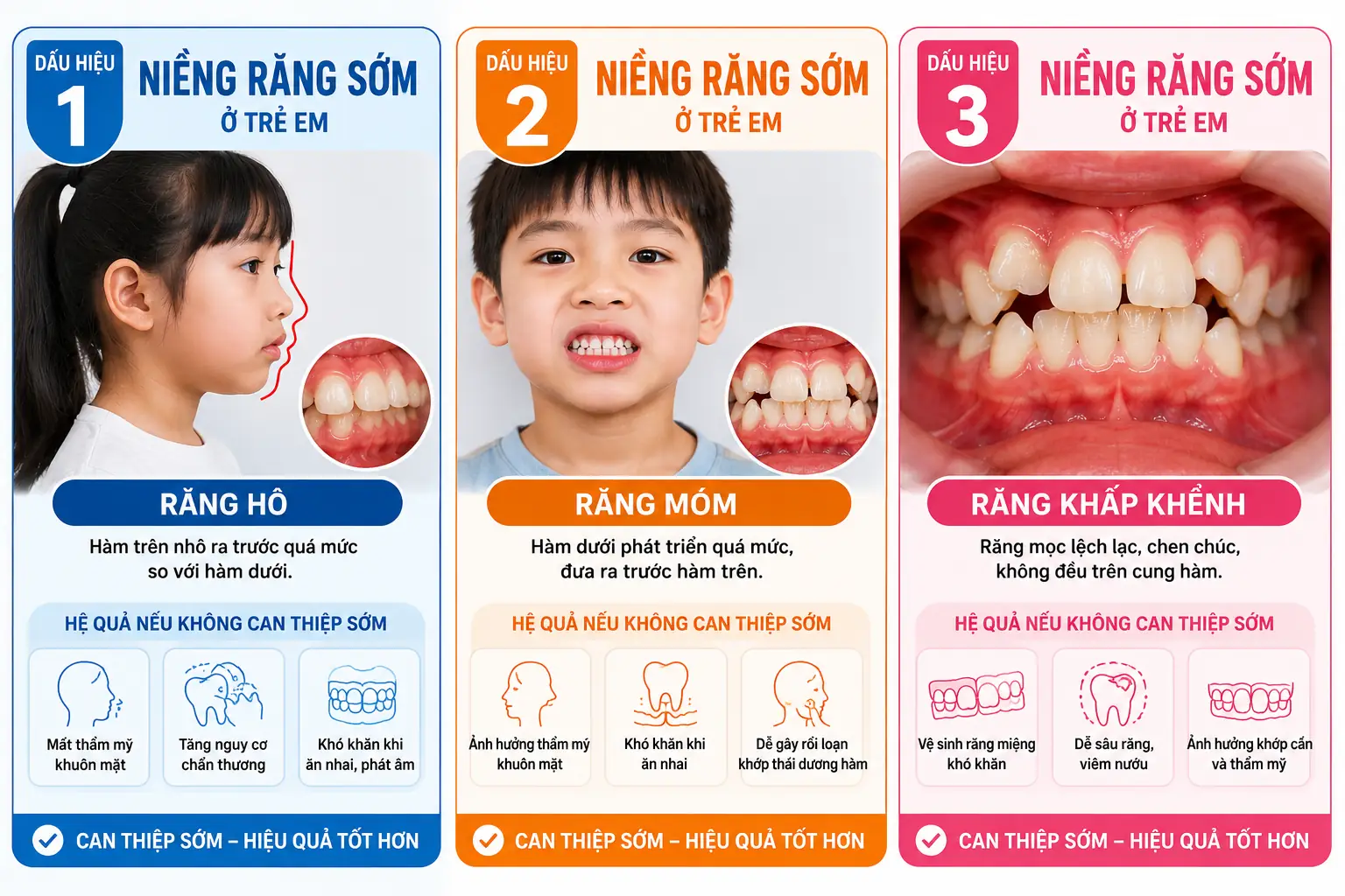 Dấu hiệu niềng răng sớm ở trẻ em